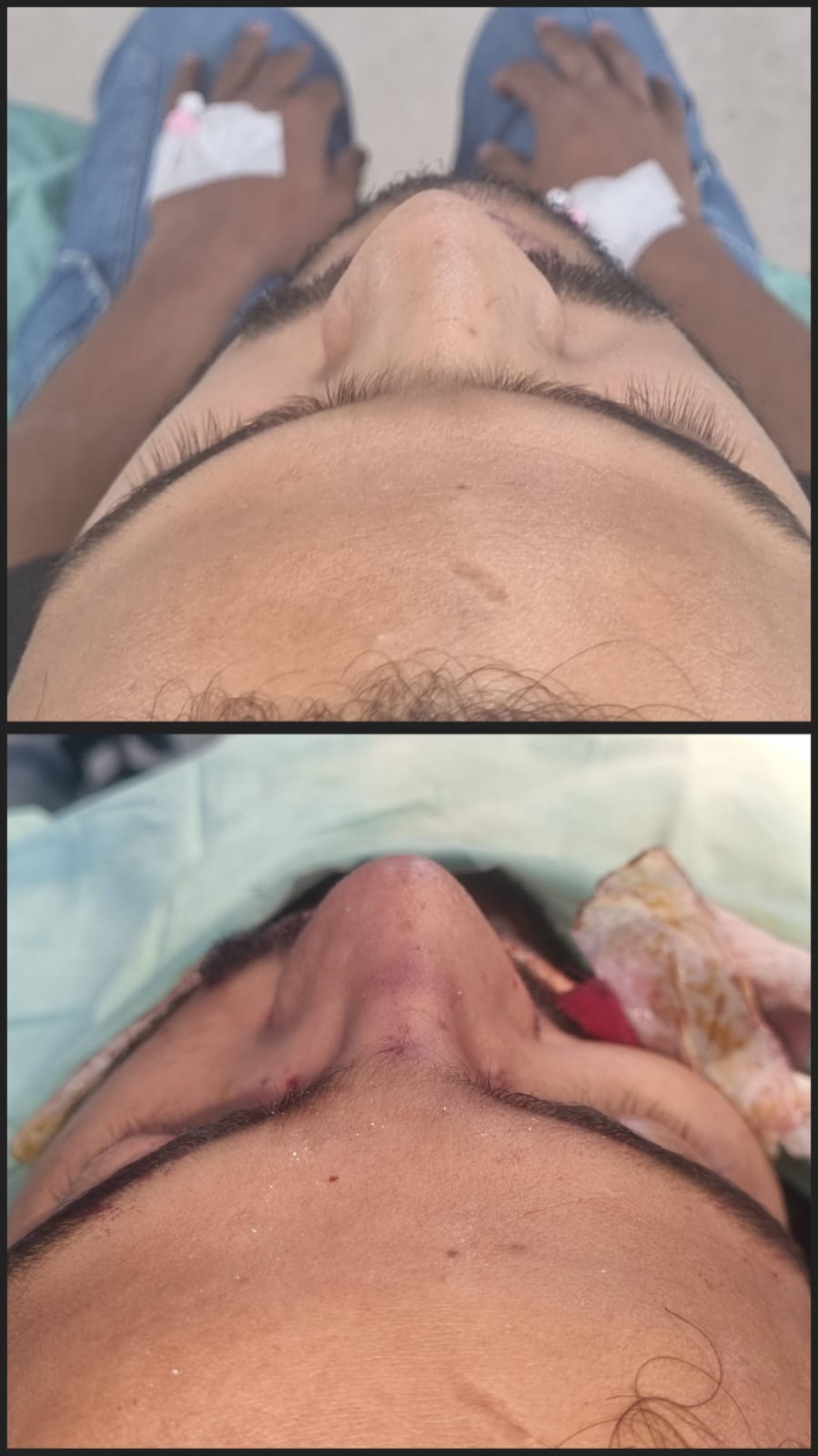 Before & After 3